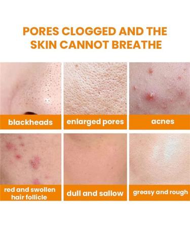 FIONEL Carrothue Carrot Bubble Clarifying Mask - Deep Cleansing & Moisturizing (3BOX) - Buy Online on GoSupps.com