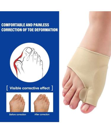WAITLOVER Zehen-Orthesen & Fußpflege: 2 St ck Korrektur Weiche Pedik re Knochen & Fußballensocken f r Optimalen Fußkomfort - Buy Online on GoSupps.com