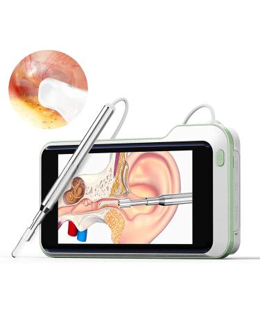 Otoscope Ear Wax Removal Kit 3.9mm HP 5 Inch Screen Digital Otoscope Handheld Visual Ear Cleaning Scope Endoscope Ear Scope for Adults Kids &Pets Green