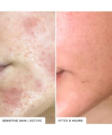 REN Clean Skincare Evercalm Overnight Recovery Balm - Nourishing Face and Body Moisturizer - Cruelty Free - 1.7 Fl Oz - Buy Online on GoSupps.com