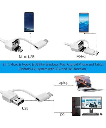 QIYUDS Ear Wax Removal Kit - 5.5mm HD Wireless Otoscope Camera with LED Lights for Adults, Kids, and Pets - Blue - Buy Online on GoSupps.com