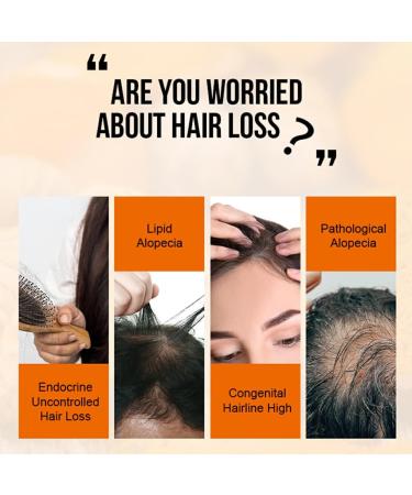 Dajidafu Ginger Hair Growth Products Thickening Prevent Regrowth Essential Oil Liquid Professional Nutrient Solution for Men - Buy Online on GoSupps.com