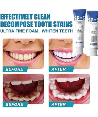 SP-6 Ultra Whitening Toothpaste 120g - Deep Cleaning Tartar Prevention & Fresh Breath - Best Ultra Whitening Formula - Buy Online on GoSupps.com