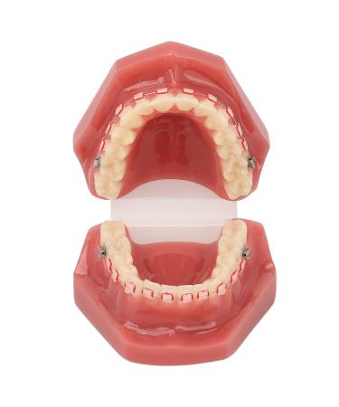 Orthodontic Demonstration Model for Dental Research | Metal Wires & Ceramic Brackets | Teaching Aids for Adults - Buy Internationally - Buy Online on GoSupps.com