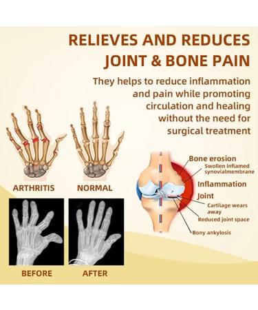 3PCS Bostore Canadian Bee Venom Alleviating Bone Pain Cvreoz Australian Honey Bee Cream New Zealand Bee Venom Joint Relief Cream Joint Relief Gel Pain Relief Cream - Buy Online on GoSupps.com