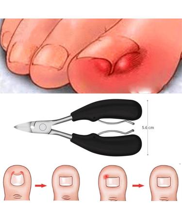 CHJHJKG Nail Clippers (Beauty) Toe Nail Clippers Remove Dead Skin Nail Correction Nippers Ingrown Toenail Cuticle Scissor Edge Cutter Thick Pedicure Care Tool(Blue) - Buy Online on GoSupps.com