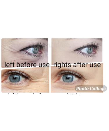Advanced Anti-Aging Eye Treatment Serum for Rapid Reduction of Under-Eye Bags, Wrinkles, and Fine Lines - Brightening Formula with Niacinamide and Hyaluronic Acid - Buy Online on GoSupps.com