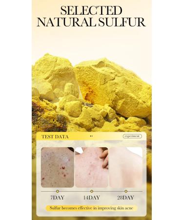 Natural Sulfur Bar Soap | Face & Body Cleanser for All Skin Types | Pore Cleaner - 4.41 Oz (Pack of 2 - Buy Online on GoSupps.com