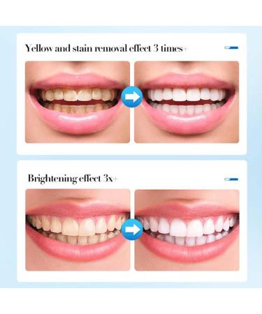 Teeth Whitening Toothpaste Foam 60ml | Bright White Teeth Mousse for Stain Removal - 1PC - Buy Online on GoSupps.com