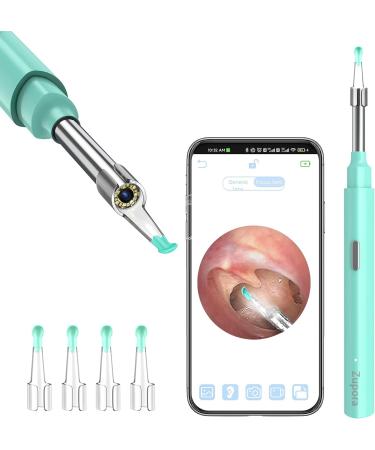Ear Wax Removal Endoscope Earwax Remover Tool 1920P FHD Wireless Ear Otoscope with LED Lights Ear Camera Ear Scope with Ear Wax Cleaner Tool for iPhone iPad & Android Smart Phones(Green)