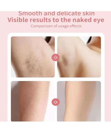 Women's Facial Epilator 2024 New Epilator Waterproof and Painless Women's Epilator Multi-function Electric Shaver Rechargeable Epilator for Face Hands Legs Armpits 1pcs - Buy Online on GoSupps.com