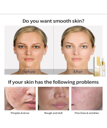 24K Mucin Snail Essence Snail Mucin Serum Face Moisturiser with Hyaluronic Acid Serum Niacinamide Serum Ginseng Extract Skincare for Hydrating Anti-Wrinkle Even Skin Tone - Buy Online on GoSupps.com