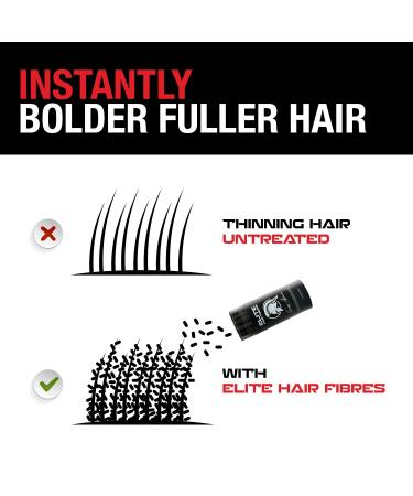 Elite Hair Fibers | All Natural Solution for Instantly Increasing Hair Density | For Men & Women | 27.5g (Medium Brown) - Buy Online on GoSupps.com