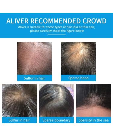 Aliver Hair Fibres Medium Brown Hair Loss Treatment - 15 Second Hair Thickener for Women & Men - Undetectable Natural Formula Spray Powder - Buy Online on GoSupps.com