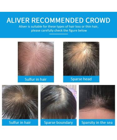 Aliver Hair Fibers for Thinning Hair & Spray - Black 27.5g - Natural Formula for Thicker Fuller Hair - Conceals Hair Loss & Adds Youthful Appearance - Men & Women - Black Spray Set - Buy Online on GoSupps.com