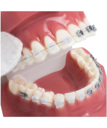 Dental Teeth Model - Orthodontic Study Tool with Metal & Ceramic for Demonstration - Buy Online on GoSupps.com