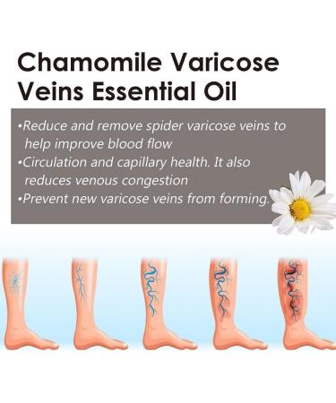GXFCAI Marrony Oil for Varicose Veins | Effective Vein Treatment Spray for Legs | 10ml - 3 Boxes - Buy Online on GoSupps.com