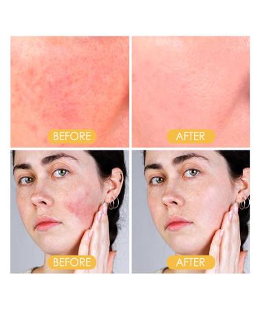 Mineral Sunscreen Setting Powder - Translucent Oil Control Face Powder for All Skin Types | Lightweight Long-Lasting Matte Finish - Buy Online on GoSupps.com