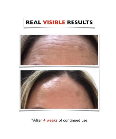 2oz. Organic Vitamin C Serum & Hyaluronic Acid for Face, Neck, Eyes - Brighten and Hydrate Your Skin - Buy Online on GoSupps.com