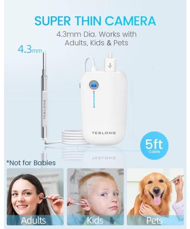 Teslong Otoscope HD Ear Wax Remover - Ultra-Thin Wireless Endoscope for iPhone & Android | NTE100i-EU - Buy Online on GoSupps.com