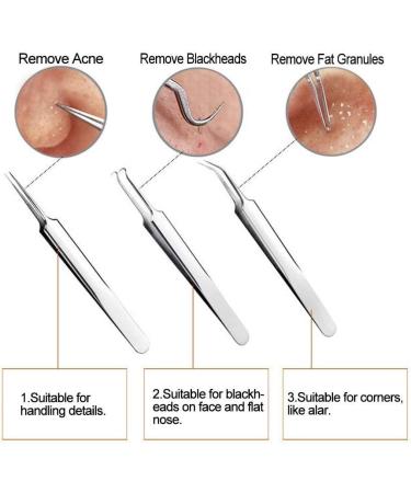Blackhead Remover Tool Kit - FEITA Acne Pimple Tweezers Comedone Extractor Blemish Removal Tool Set for Facial Whitehead Popping Zit Removing - Buy Online on GoSupps.com
