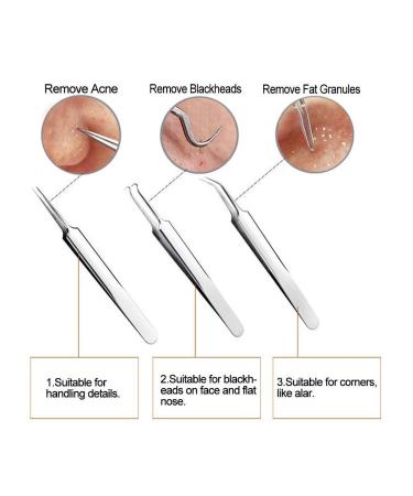 FEITA Blackhead Remover Kit - 5 Pcs Acne Tweezers & Extractor Set with Travel Case - Buy Online on GoSupps.com