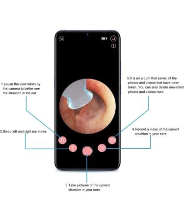 QDCFY Ear Wax Removal Set with 3.5mm Camera 6 LED Lights - Safe Ear Cleaning Tools for Adults Children & Babies (Black) - Buy Online on GoSupps.com