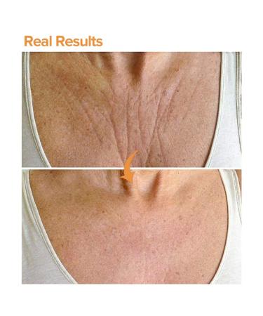 2 Pack Silicone Chest Wrinkle Pads - Reusable Anti-Wrinkle Decollete Patches - Buy Online on GoSupps.com