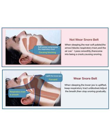 Premium Anti-Snoring Chin Strap for Men and Women - Snore Reduction for Better Sleep (Random Delivery) - Buy Online on GoSupps.com