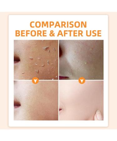 Orange Face Exfoliator Gel Vitamin C Exfoliating Face Scrub Whitening Body Scrub Deep Exfoliating Face Wash Body Scrub Exfoliator Facial Scrub Orange Exfoliating Whitening Gel Scrub Face Body Skin - Buy Online on GoSupps.com