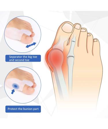 Buy Hallux Valgus Toe Spreader - 2 Pairs of Soft Gel Bunion Protectors for Men & Women | Alleviate Pain & Ensure Comfort - Buy Online on GoSupps.com