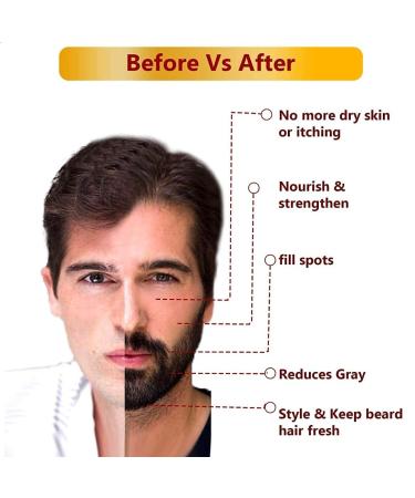 SODEN Advanced Beard Growth Oil - 2 x 30 ml | Stimulate Root & Follicle for Thicker Beards - Buy Online on GoSupps.com