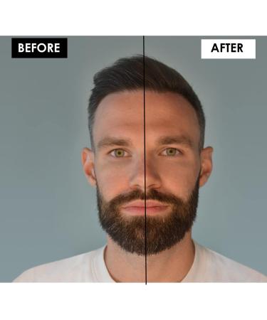 Maybelline New York Drops Cover for Men - Skin Care Concealer 5 Shades No. 03 Fair Conceals Eye Rings & Pimples 6.8 ml - International Shipping Available - Buy Online on GoSupps.com