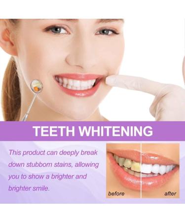 Shop Lila Tooth White Stripes - Powerful Whitening Kit | Color Correction & Essential Oils | Peroxide-Free & Sensitive Friendly | International Shipping - Buy Online on GoSupps.com