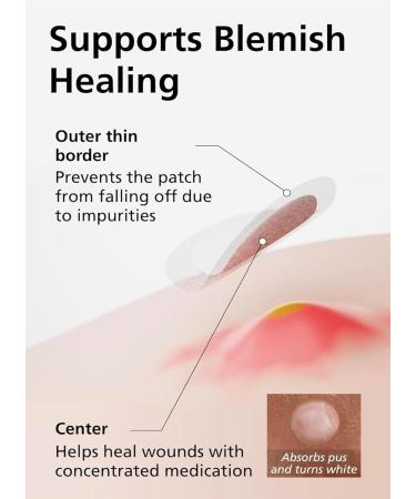 EasyDerm Pimple Patch Duo Bundle 168 Patches (4 Counts) | Beauty Hydrocolloid Patch + Relief Invisible Patch Tea Tree Oil for Zit Blemish Breakout Care Under Make up Pimple Patch 4 Count Duo Pack - Buy Online on GoSupps.com