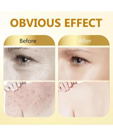 Bee Venom Cream Natural Bee Venom Skin Treatment Cream-for Removing and Repair Effective In Reducing Skin Blemishes Gentle and Non-irritating(Gold) - Buy Online on GoSupps.com