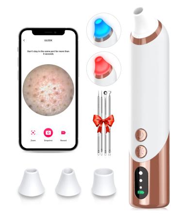 Blackhead Remover Pore Vacuum with Camera & 3 Silicone Suction Heads & Pimple Extractor Kit  WiFi Visible Pore Cleaner USB Rechargeable Black Head Remover White