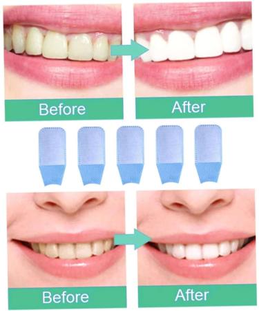 10pcs Oral Hygiene Wipes | Toothbrush & Finger Sweat Care | International Shipping - Buy Online on GoSupps.com