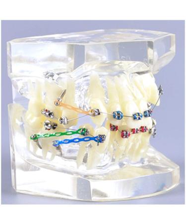 Dytah Dental Painting Model - Orthodontic Treatment with Brackets & Buccal Tube for Malocclusion Study & Lessons - Buy Online on GoSupps.com