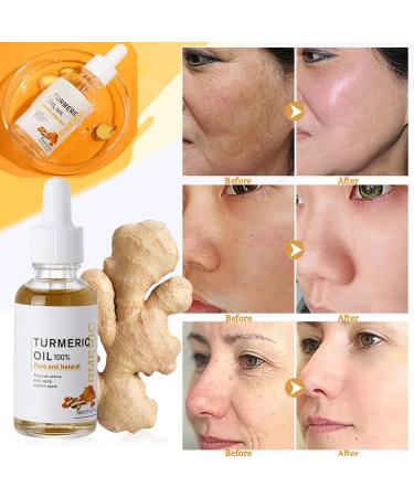 Turmeric Dark Spot Corrector Serum - Acne & Melasma Remover for Face & Body - Ginger Root Extract - 2PCS - Buy Online on GoSupps.com
