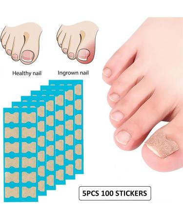 Toenail Patch Ingrown Toenail Toenail Correction Toenail Correction Patch Toenail Correction Patch Ingrown Toenail Nail Care 50 Pieces - Buy Online on GoSupps.com