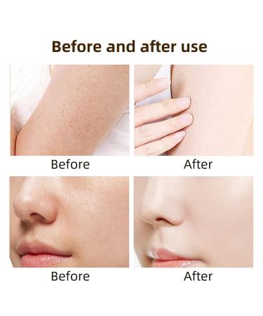 Snail Mucin Gel Cleanser - 5.07 Fl Oz | High Potency for Dry & Sensitive Skin | Korean Skincare with 97% Mucin Power - Buy Online on GoSupps.com