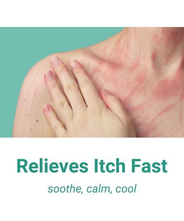 Extra Strength Anti Itch Cream - Long Lasting Relief for Rash Eczema Psoriasis & More - 3.53 OZ - Buy Online on GoSupps.com