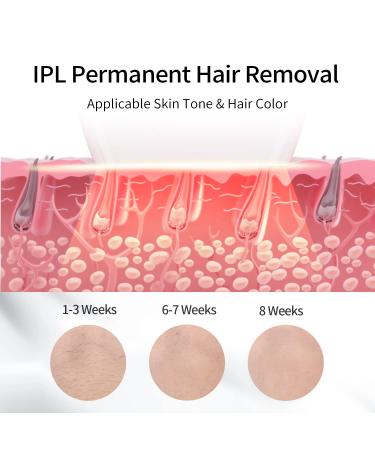 COSBEAUTY IPL Hair Removal Device for Women and Men - FDA Cleared, Permanent & Painless Laser Hair Remover for Face and Body - 3 Treatment Heads (CB027-White) - Buy Online on GoSupps.com