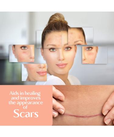 Brittanie's Thyme Skin Repair Accelerator for Scars & Stretchmarks | Natural Non-Toxic Treatment, Dermatologist Recommended for Deep Nourishment, Wrinkle Reduction, and Itchy Skin - Ideal for Damaged Skin & Tattoos - Buy Online on GoSupps.com