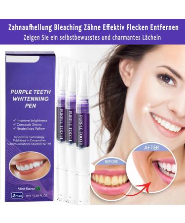 Purple Teeth Whitening Pen - Fast & Painless Tooth Whitening at Home | Mint Flavor - Achieve Bright White Teeth - Buy Online on GoSupps.com