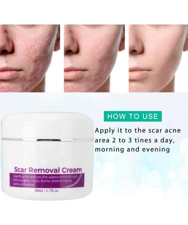 Scar Removal Cream with Plant Extract Stretch Marks & Scars Repair Gel 50ml for Fading Scar and Remove Stretch Marks - Buy Online on GoSupps.com