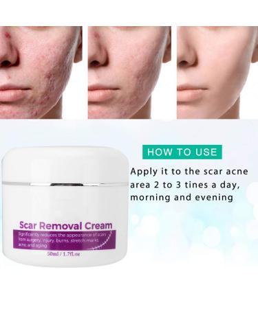 Effective Stretch Marks & Scar Removal Cream | Skin Repair Formula for All Skin Types - Buy Online on GoSupps.com