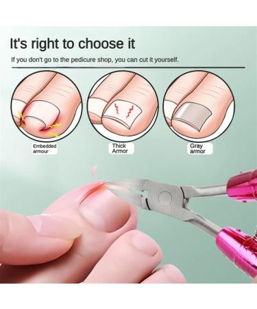 Toe Nail Clippers Dead Skin Remove Thick Nails Ingrown Nail Cutter Mermaid Stainless Steel Mouth Pliers Manicure Tools (Color : Red) - Buy Online on GoSupps.com