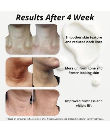 Neck Tightening Cream with Argireline AH-8 Bakuchiol Hyaluronic Acid & Alpha Arbutin Firming Moisturizer for Face Neck & D collet Anti-Wrinkle Cream for Women & Men 1.76 Oz - Buy Online on GoSupps.com